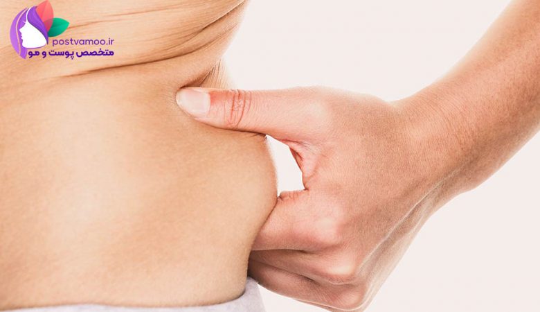 بهترین جراح پیکرتراشی در شیراز