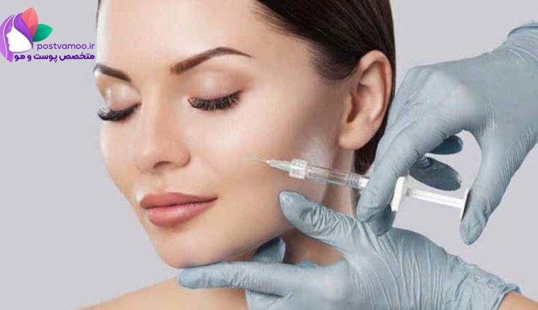 تزریق ژل و نکات طلایی که درباره آن باید بدانید!